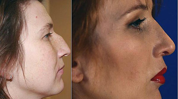 Операция красота, 1+1, фото до и после, Оксана Сидоренко, пластические операции