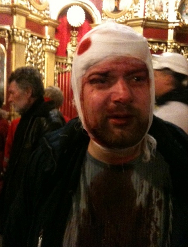 Журналисты, ранили журналиста, Глеб Гаранич, разорвалась граната, Максим Требухов, Партия регионов, избила охрана, сломали нос